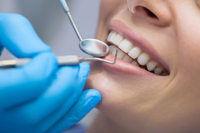 A dental professional performing a teeth cleaning procedure on a patient, with the patient s mouth open and the dental professional using specialized tools.