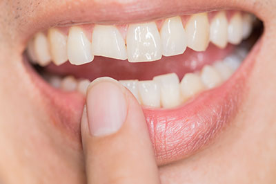 The image depicts a person with a broad smile, showing their teeth and tongue, with a hand holding an object close to the mouth.