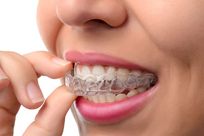 The image shows a person with their hand to their mouth, holding an object that appears to be a dental appliance or retainer.