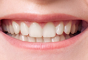 A close-up of a person s smiling mouth showing white teeth.
