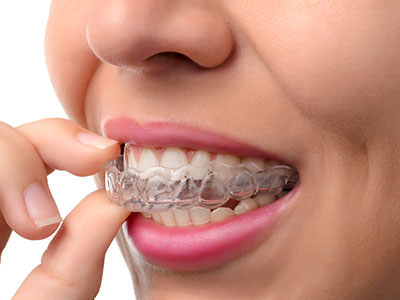 Woman with clear aligner, inspecting her teeth.