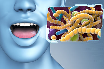 The image features a 3D rendering of a person s face with an open mouth, displaying a yellowish-green substance that resembles bacteria or viruses, set against a blue background.