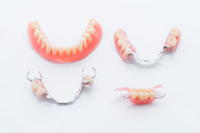 Image  A set of three dental bridges with artificial teeth, displayed against a white background.